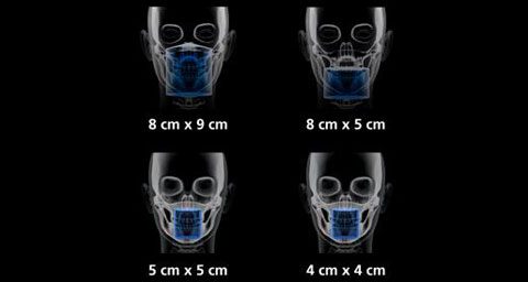 歯科用3DCTセファロ複合機　CT撮影範囲